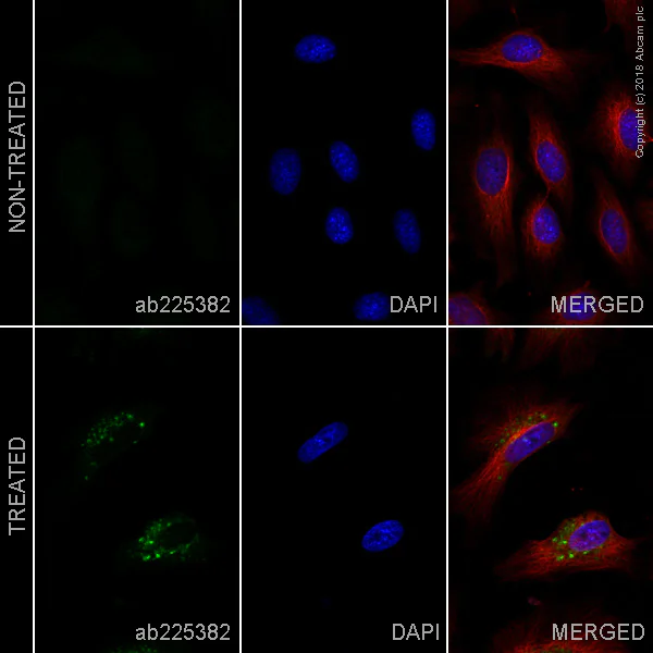 Immunocytochemistry/ Immunofluorescence - Alexa Fluor® 488 Anti-LC3B antibody [EPR18709] - Autophagosome Marker (AB225382)