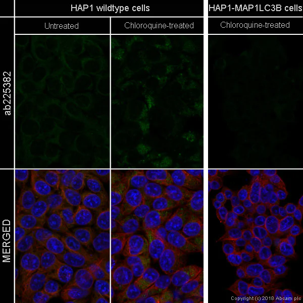 Immunocytochemistry/ Immunofluorescence - Alexa Fluor® 488 Anti-LC3B antibody [EPR18709] - Autophagosome Marker (AB225382)