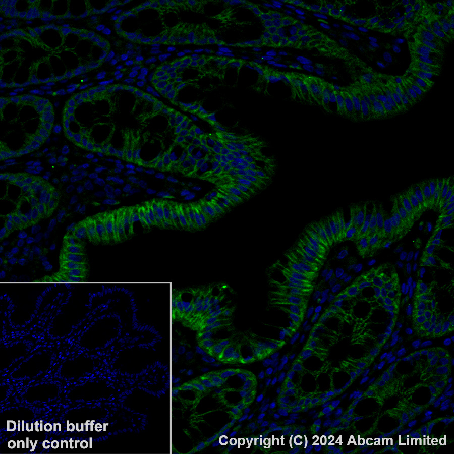 Immunohistochemistry (Formalin/PFA-fixed paraffin-embedded sections) - Alexa Fluor® 488 Anti-LI Cadherin antibody [EPR3996] (AB323998), expandable thumbnail