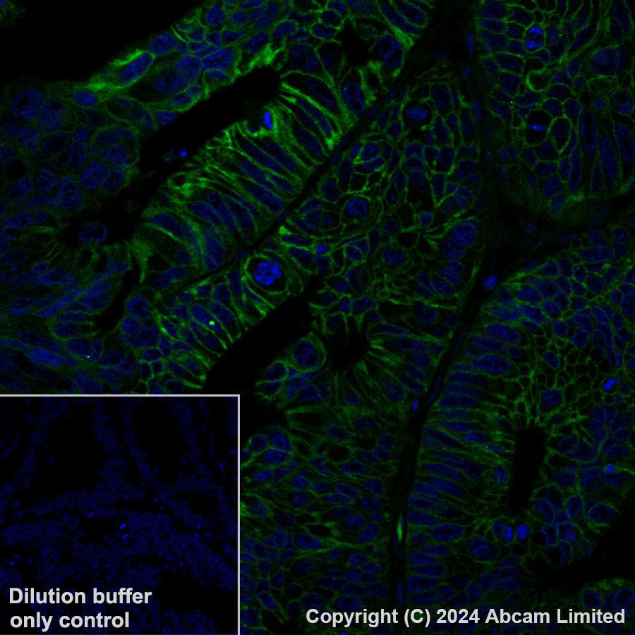 Immunohistochemistry (Formalin/PFA-fixed paraffin-embedded sections) - Alexa Fluor® 488 Anti-LI Cadherin antibody [EPR3996] (AB323998), expandable thumbnail