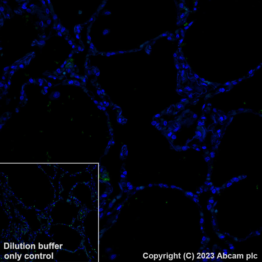 Immunohistochemistry (Formalin/PFA-fixed paraffin-embedded sections) - Alexa Fluor® 488 Anti-LINE-1 ORF1p antibody [EPR22227-6] (AB315135), expandable thumbnail
