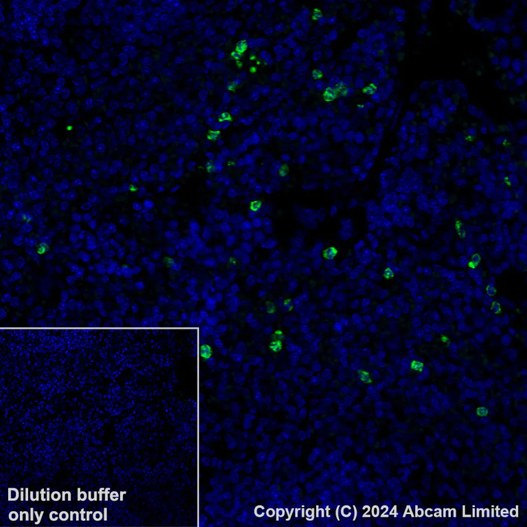 Immunohistochemistry (Formalin/PFA-fixed paraffin-embedded sections) - Alexa Fluor® 488 Anti-Lipocalin-2 / NGAL antibody [EPR21092] (AB321939)