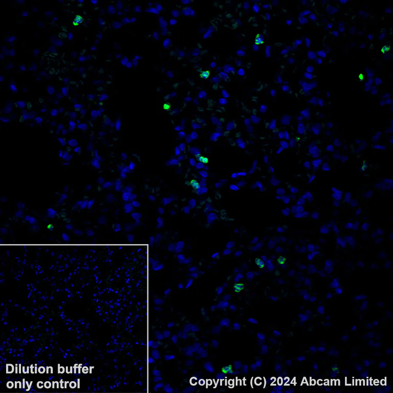 Immunohistochemistry (Formalin/PFA-fixed paraffin-embedded sections) - Alexa Fluor® 488 Anti-Lipocalin-2 / NGAL antibody [EPR21092] (AB321939)