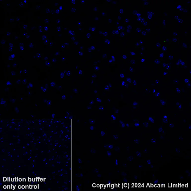 Immunohistochemistry (Formalin/PFA-fixed paraffin-embedded sections) - Alexa Fluor® 488 Anti-Lipocalin-2 / NGAL antibody [EPR21092] (AB321939)