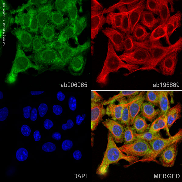 Immunocytochemistry/ Immunofluorescence - Alexa Fluor® 488 Anti-Lipocalin-2 / NGAL antibody [EPR5084] (AB206085), expandable thumbnail