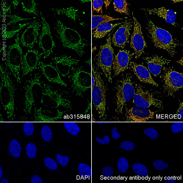 Immunocytochemistry/ Immunofluorescence - Alexa Fluor® 488 Anti-LRPPRC/GP130 antibody [EPR24052-38] (AB315848), expandable thumbnail