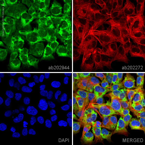 Immunocytochemistry/ Immunofluorescence - Alexa Fluor® 488 Anti-LYRIC/AEG1 antibody [EP4445] (AB202944)