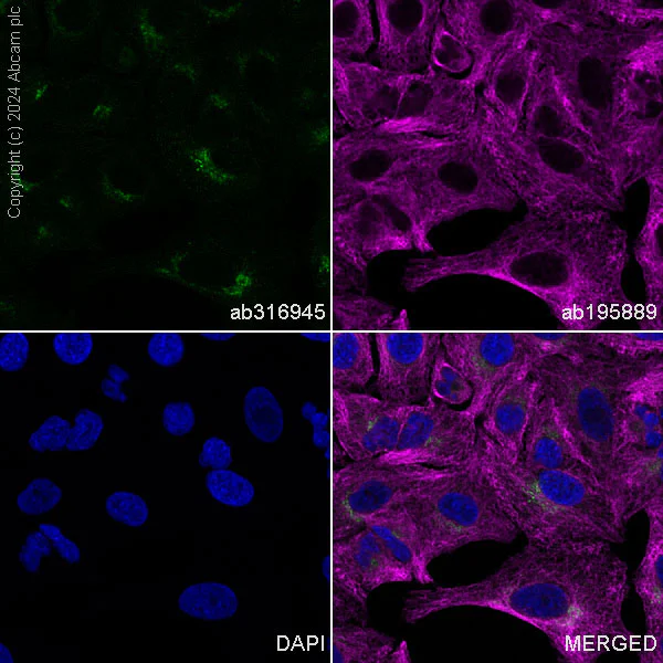Immunocytochemistry/ Immunofluorescence - Alexa Fluor® 488 Anti-M6PR (cation dependent) antibody [EPR7691] (AB316945)