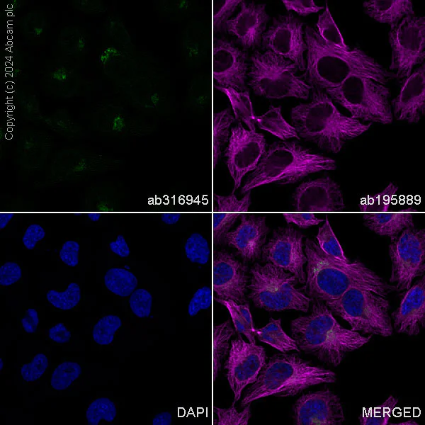 Immunocytochemistry/ Immunofluorescence - Alexa Fluor® 488 Anti-M6PR (cation dependent) antibody [EPR7691] (AB316945)