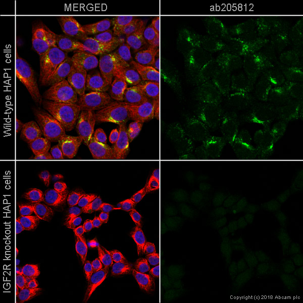 Immunocytochemistry/ Immunofluorescence - Alexa Fluor® 488 Anti-M6PR (cation independent) antibody [2G11] - Lysosome Membrane Marker (AB205812)
