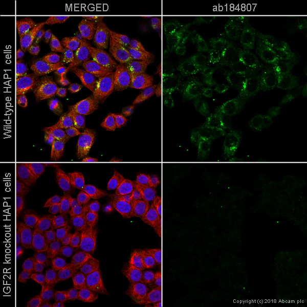 Immunocytochemistry/ Immunofluorescence - Alexa Fluor® 488 Anti-M6PR (cation independent) antibody [EPR6599] - Lysosome Membrane Marker (AB184807)
