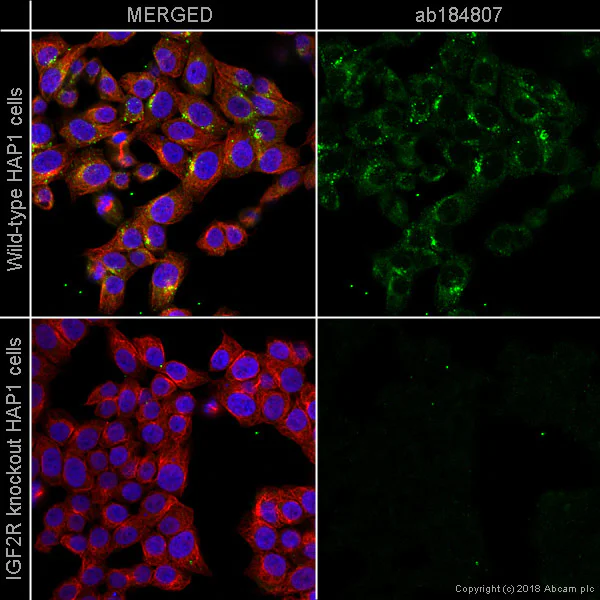 Immunocytochemistry/ Immunofluorescence - Alexa Fluor® 488 Anti-M6PR (cation independent) antibody [EPR6599] - Lysosome Membrane Marker (AB184807)