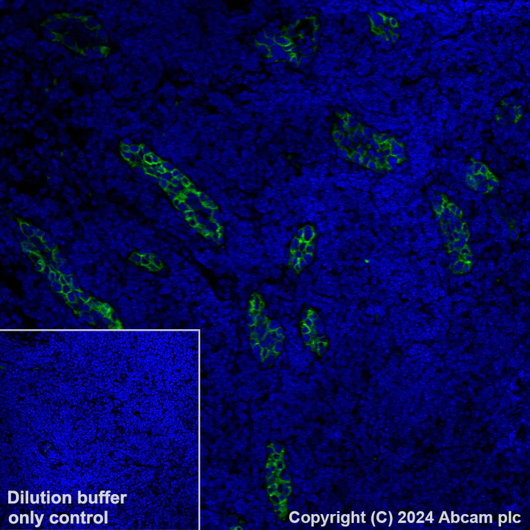 Immunohistochemistry (Formalin/PFA-fixed paraffin-embedded sections) - Alexa Fluor® 488 Anti-MAdCAM1 antibody [EPR27223-58] (AB318243)