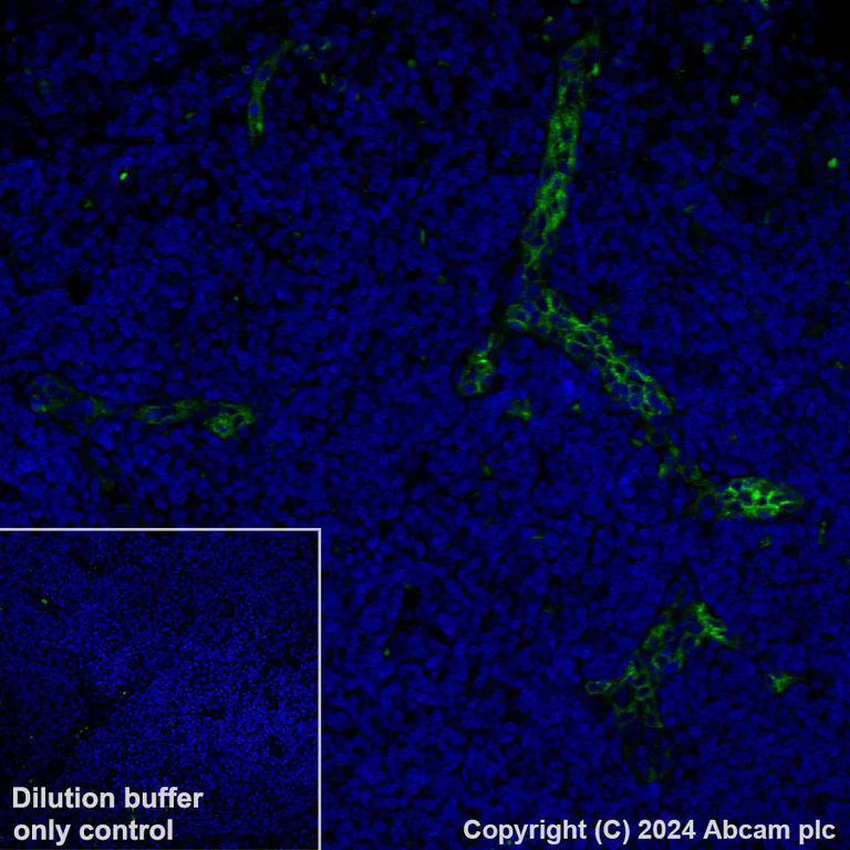 Immunohistochemistry (Formalin/PFA-fixed paraffin-embedded sections) - Alexa Fluor® 488 Anti-MAdCAM1 antibody [EPR27223-58] (AB318243)