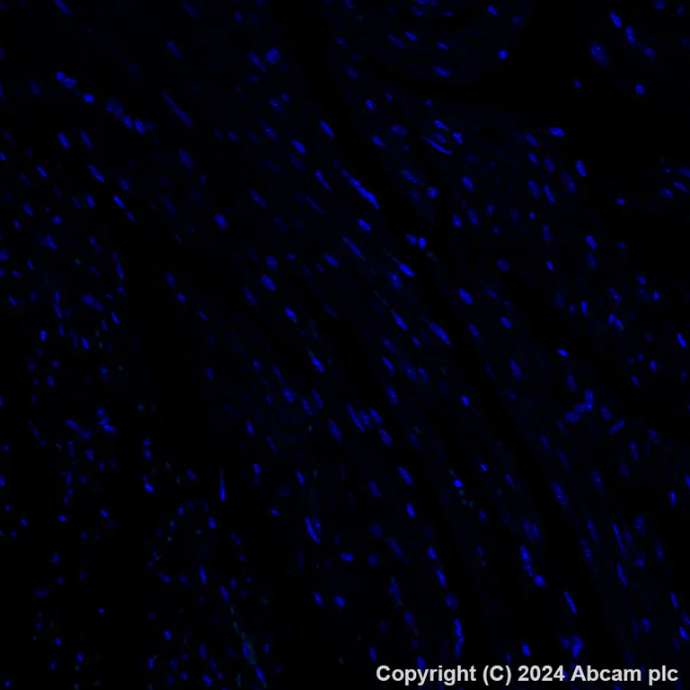 Immunohistochemistry (Formalin/PFA-fixed paraffin-embedded sections) - Alexa Fluor® 488 Anti-MAdCAM1 antibody [EPR27223-58] (AB318243)