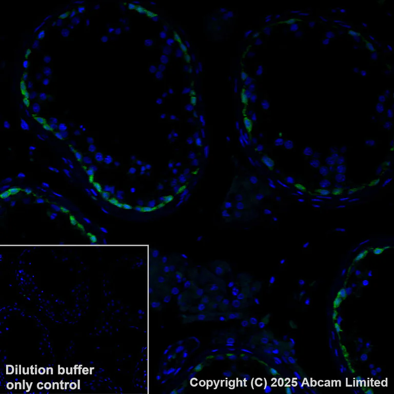 Immunohistochemistry (Formalin/PFA-fixed paraffin-embedded sections) - Alexa Fluor® 488 Anti-MAGEA4 antibody [EPR26098-164] (AB325694)