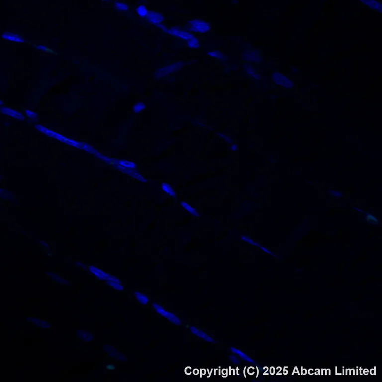 Immunohistochemistry (Formalin/PFA-fixed paraffin-embedded sections) - Alexa Fluor® 488 Anti-MAGEA4 antibody [EPR26098-164] (AB325694)