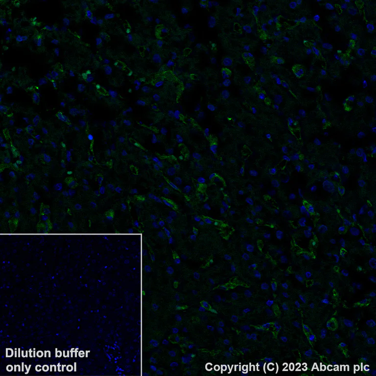 Immunohistochemistry (Formalin/PFA-fixed paraffin-embedded sections) - Alexa Fluor® 488 Anti-Mannose Receptor antibody [EPR22489-7] (AB313398)