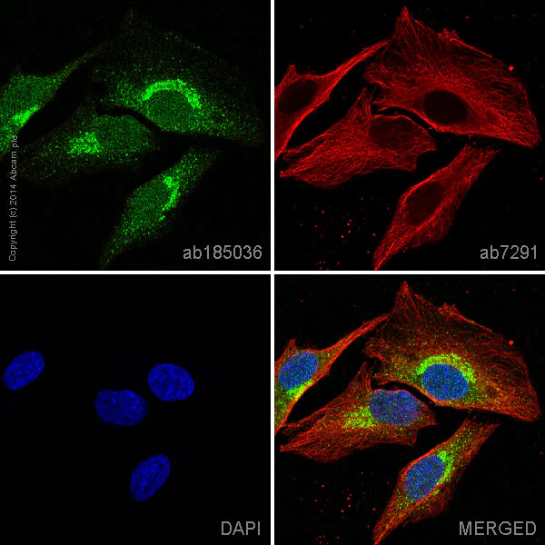 Immunocytochemistry/ Immunofluorescence - Alexa Fluor® 488 Anti-MAP1LC3A antibody [EP1983Y] - Autophagosome Marker (AB185036)
