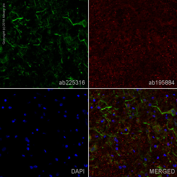 Immunohistochemistry (Frozen sections) - Alexa Fluor® 488 Anti-MAP2 antibody [EPR19691] - Neuronal Marker (AB225316), expandable thumbnail