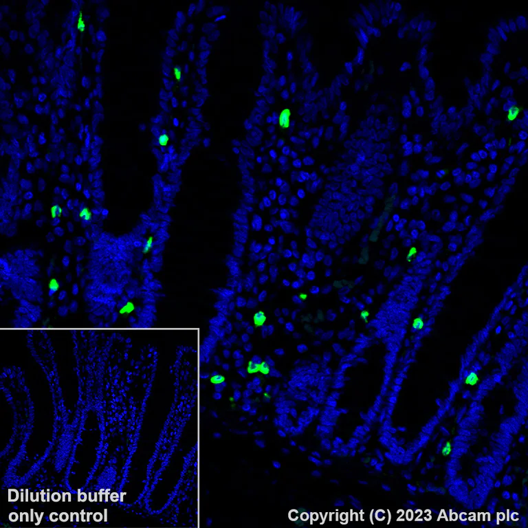 Immunohistochemistry (Formalin/PFA-fixed paraffin-embedded sections) - Alexa Fluor® 488 Anti-Mast Cell Tryptase antibody [EPR9522] (AB314594)