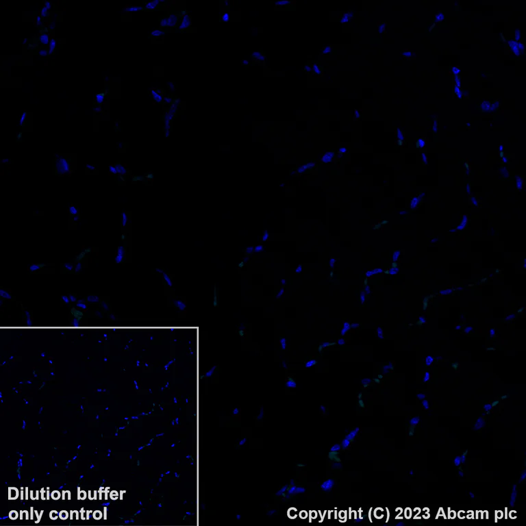 Immunohistochemistry (Formalin/PFA-fixed paraffin-embedded sections) - Alexa Fluor® 488 Anti-Mast Cell Tryptase antibody [EPR9522] (AB314594)