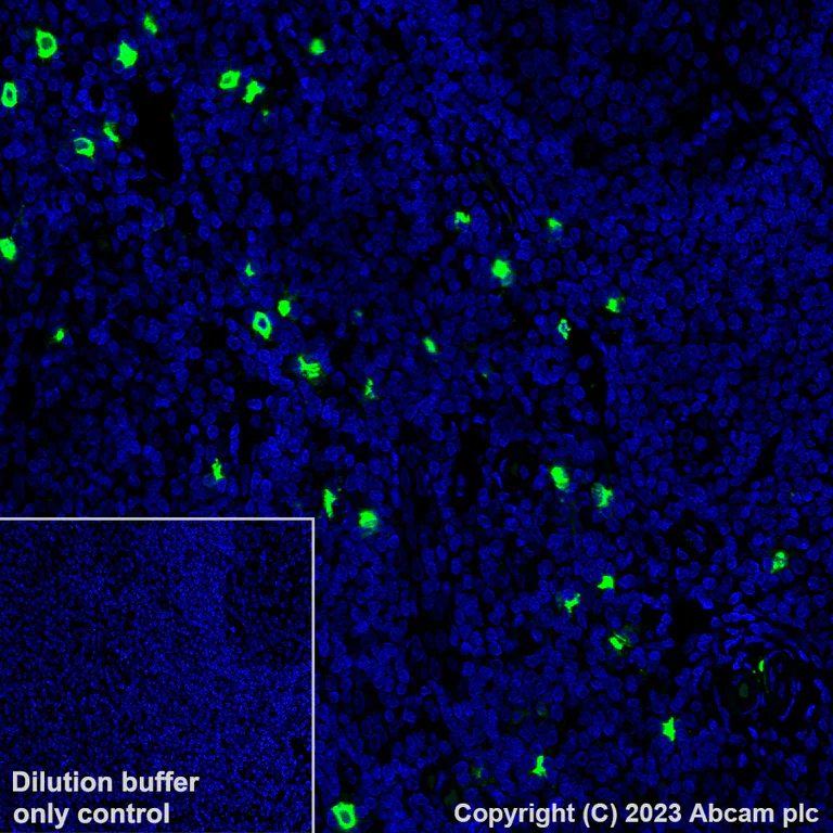 Immunohistochemistry (Formalin/PFA-fixed paraffin-embedded sections) - Alexa Fluor® 488 Anti-Mast Cell Tryptase antibody [EPR9522] (AB314594)