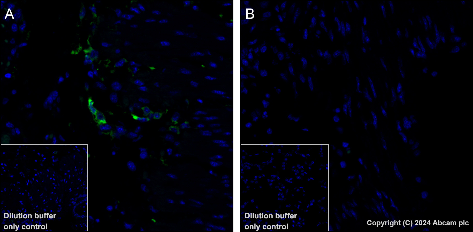 Immunohistochemistry (Formalin/PFA-fixed paraffin-embedded sections) - Alexa Fluor® 488 Anti-MCP1 antibody [EPR27464-89] (AB316343), expandable thumbnail