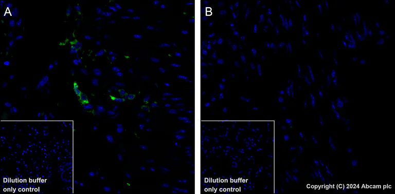 Immunohistochemistry (Formalin/PFA-fixed paraffin-embedded sections) - Alexa Fluor® 488 Anti-MCP1 antibody [EPR27464-89] (AB316343)