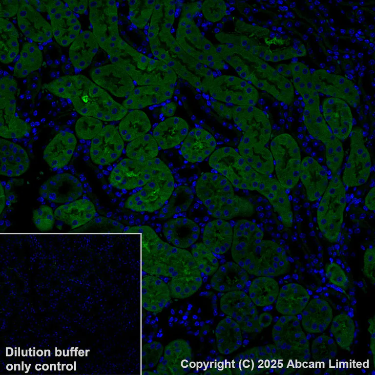 Immunohistochemistry (Formalin/PFA-fixed paraffin-embedded sections) - Alexa Fluor® 488 Anti-ME1 antibody [EPR28891-30] (AB324366)