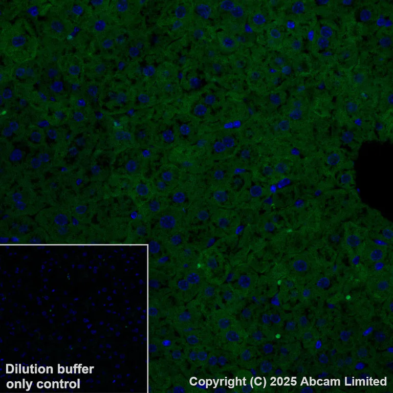 Immunohistochemistry (Formalin/PFA-fixed paraffin-embedded sections) - Alexa Fluor® 488 Anti-ME1 antibody [EPR28891-30] (AB324366)