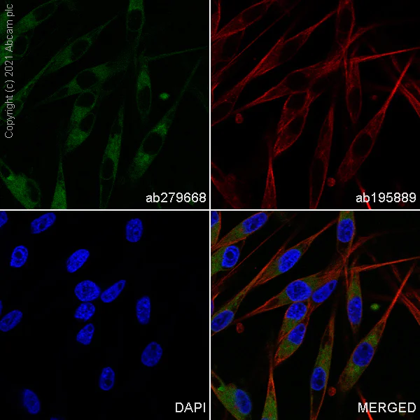 Immunocytochemistry/ Immunofluorescence - Alexa Fluor® 488 Anti-MelanA antibody [EP1422Y] (AB279668)
