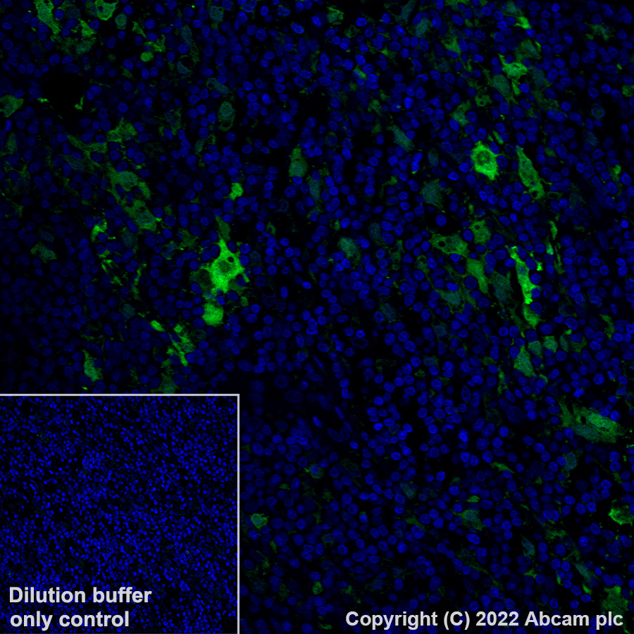 Immunohistochemistry (Formalin/PFA-fixed paraffin-embedded sections) - Alexa Fluor® 488 Anti-MERTK antibody [Y323] (AB307385), expandable thumbnail