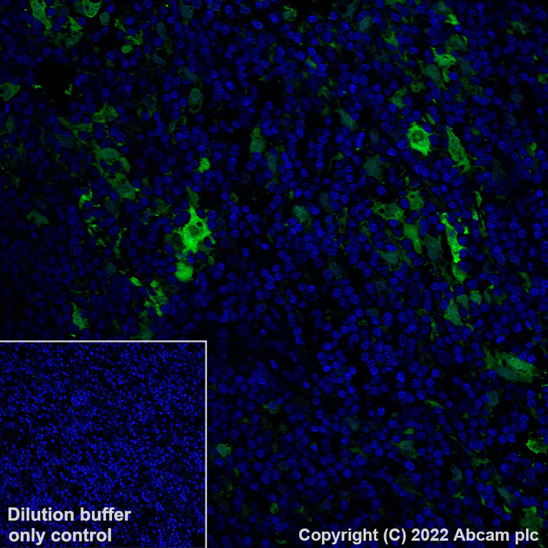 Immunohistochemistry (Formalin/PFA-fixed paraffin-embedded sections) - Alexa Fluor® 488 Anti-MERTK antibody [Y323] (AB307385)