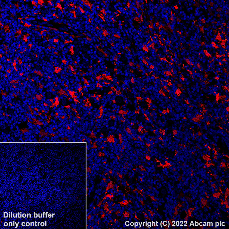 Immunohistochemistry (Formalin/PFA-fixed paraffin-embedded sections) - Alexa Fluor® 488 Anti-MERTK antibody [Y323] (AB307385)