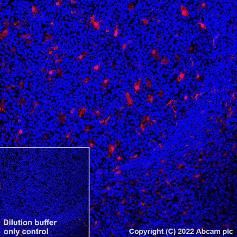 Immunohistochemistry (Formalin/PFA-fixed paraffin-embedded sections) - Alexa Fluor® 488 Anti-MERTK antibody [Y323] (AB307385)