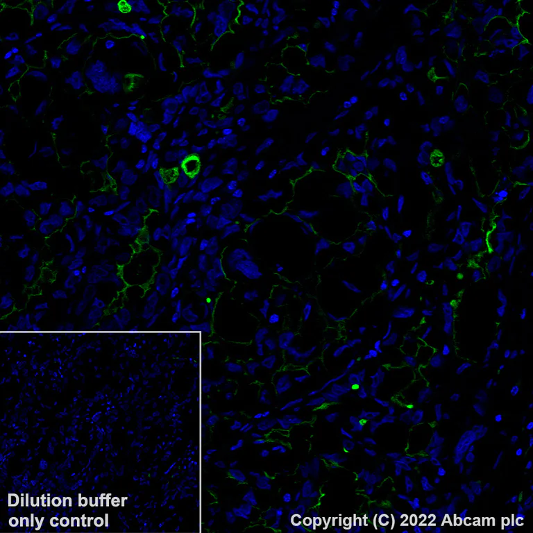 Immunohistochemistry (Formalin/PFA-fixed paraffin-embedded sections) - Alexa Fluor® 488 Anti-Mesothelin antibody [EPR19025-42] (AB315357)