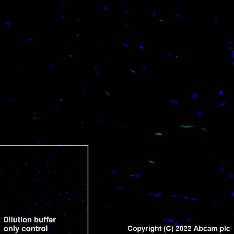 Immunohistochemistry (Formalin/PFA-fixed paraffin-embedded sections) - Alexa Fluor® 488 Anti-Mesothelin antibody [EPR19025-42] (AB315357)