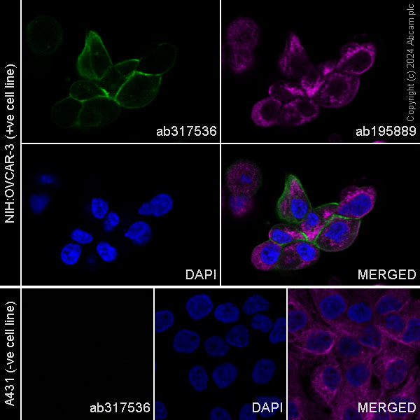 Immunocytochemistry/ Immunofluorescence - Alexa Fluor® 488 Anti-Mesothelin antibody [EPR28269-62] (AB317536), expandable thumbnail