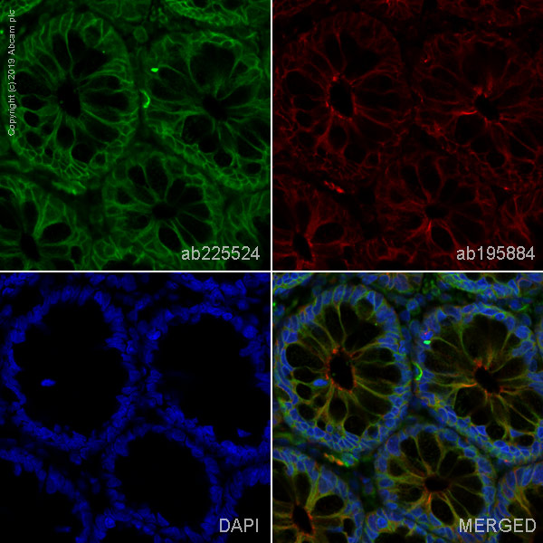 Immunohistochemistry (Formalin/PFA-fixed paraffin-embedded sections) - Alexa Fluor® 488 Anti-Met (c-Met) antibody [EPR19067] (AB225524), expandable thumbnail