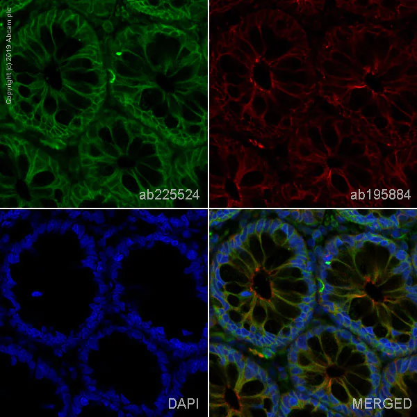 Immunohistochemistry (Formalin/PFA-fixed paraffin-embedded sections) - Alexa Fluor® 488 Anti-Met (c-Met) antibody [EPR19067] (AB225524)