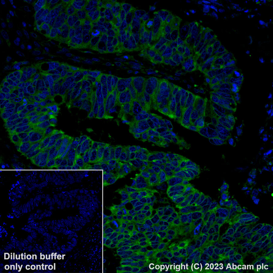 Immunohistochemistry (Formalin/PFA-fixed paraffin-embedded sections) - Alexa Fluor® 488 Anti-Met (c-Met) - C-terminal antibody [SP44] (AB314588), expandable thumbnail