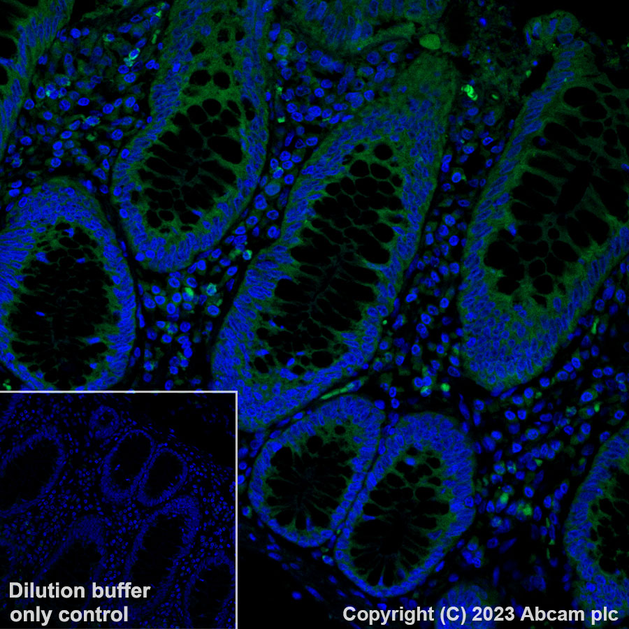 Immunohistochemistry (Formalin/PFA-fixed paraffin-embedded sections) - Alexa Fluor® 488 Anti-Met (c-Met) - C-terminal antibody [SP44] (AB314588), expandable thumbnail