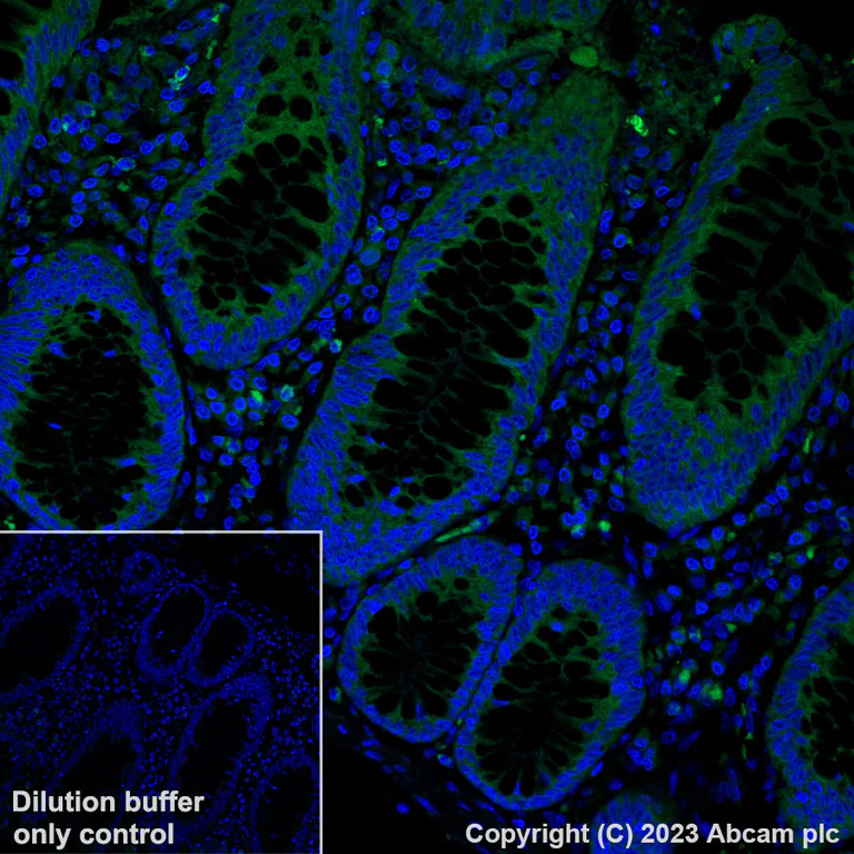Immunohistochemistry (Formalin/PFA-fixed paraffin-embedded sections) - Alexa Fluor® 488 Anti-Met (c-Met) - C-terminal antibody [SP44] (AB314588)