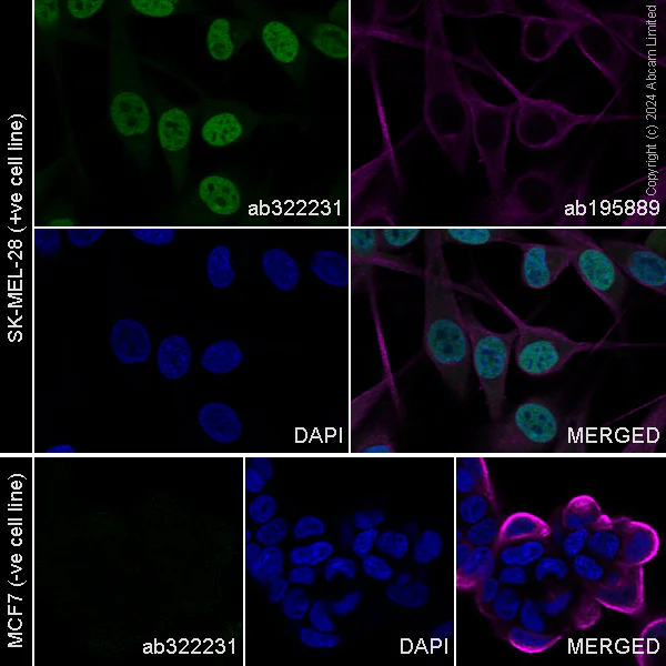 Immunocytochemistry/ Immunofluorescence - Alexa Fluor® 488 Anti-MiTF antibody [EPR26363-10] (AB322231)