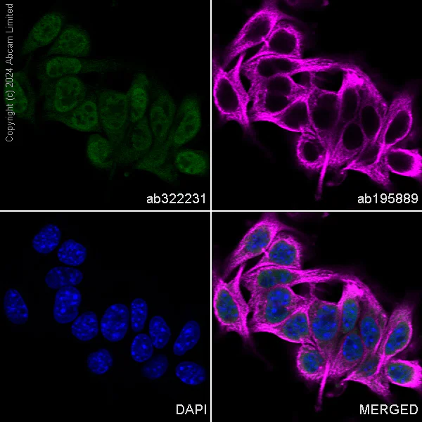 Immunocytochemistry/ Immunofluorescence - Alexa Fluor® 488 Anti-MiTF antibody [EPR26363-10] (AB322231)
