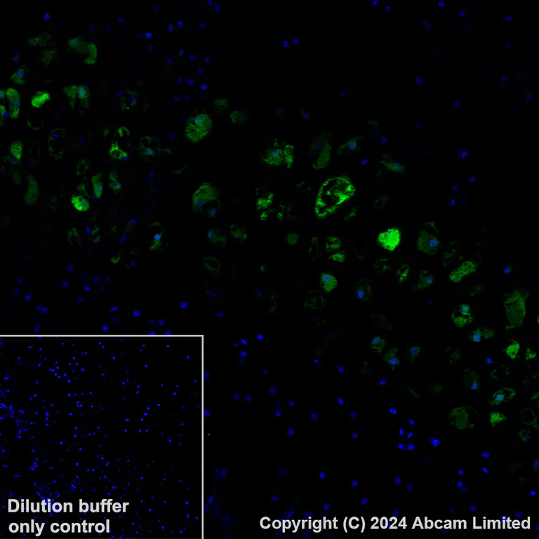 Immunohistochemistry (Formalin/PFA-fixed paraffin-embedded sections) - Alexa Fluor® 488 Anti-MMP13 antibody [EPR25858-87] (AB319183)