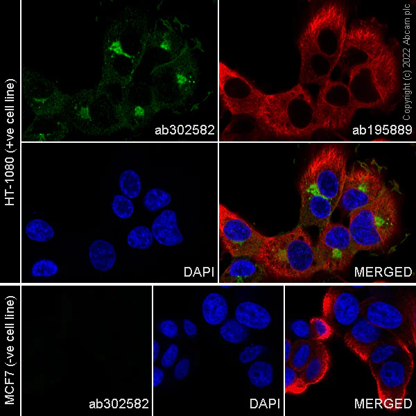 Immunocytochemistry/ Immunofluorescence - Alexa Fluor® 488 Anti-MMP14 antibody [EP1264Y] (AB302582)