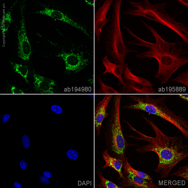 Immunocytochemistry/ Immunofluorescence - Alexa Fluor® 488 Anti-MMP3 antibody [EP1186Y] (AB194980), expandable thumbnail
