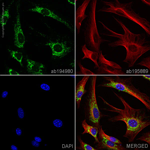 Immunocytochemistry/ Immunofluorescence - Alexa Fluor® 488 Anti-MMP3 antibody [EP1186Y] (AB194980)